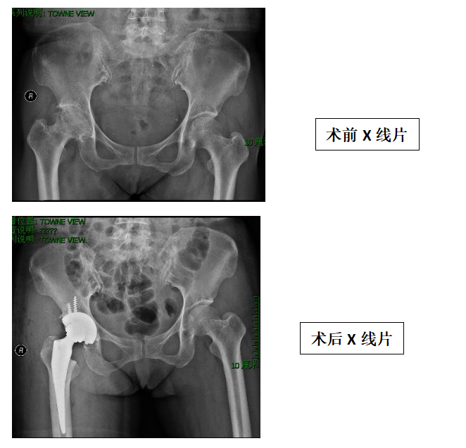 關(guān)節(jié)、運動醫(yī)學(xué)科特色技術(shù)